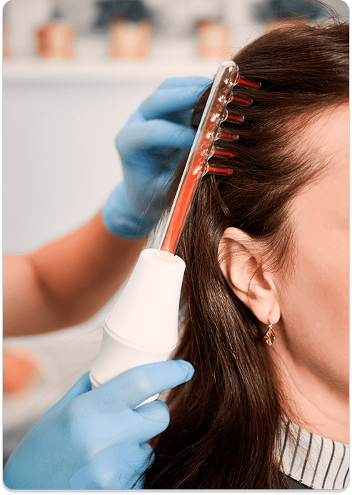 Haartransplantation bei Frauen