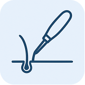 DHI-Haartransplantation