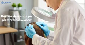 Rekonwalescencja po przeszczepie włosów – jak wygląda i na co zwrócić uwagę? 1 rekonwalescencja po przeszczepie wlosow